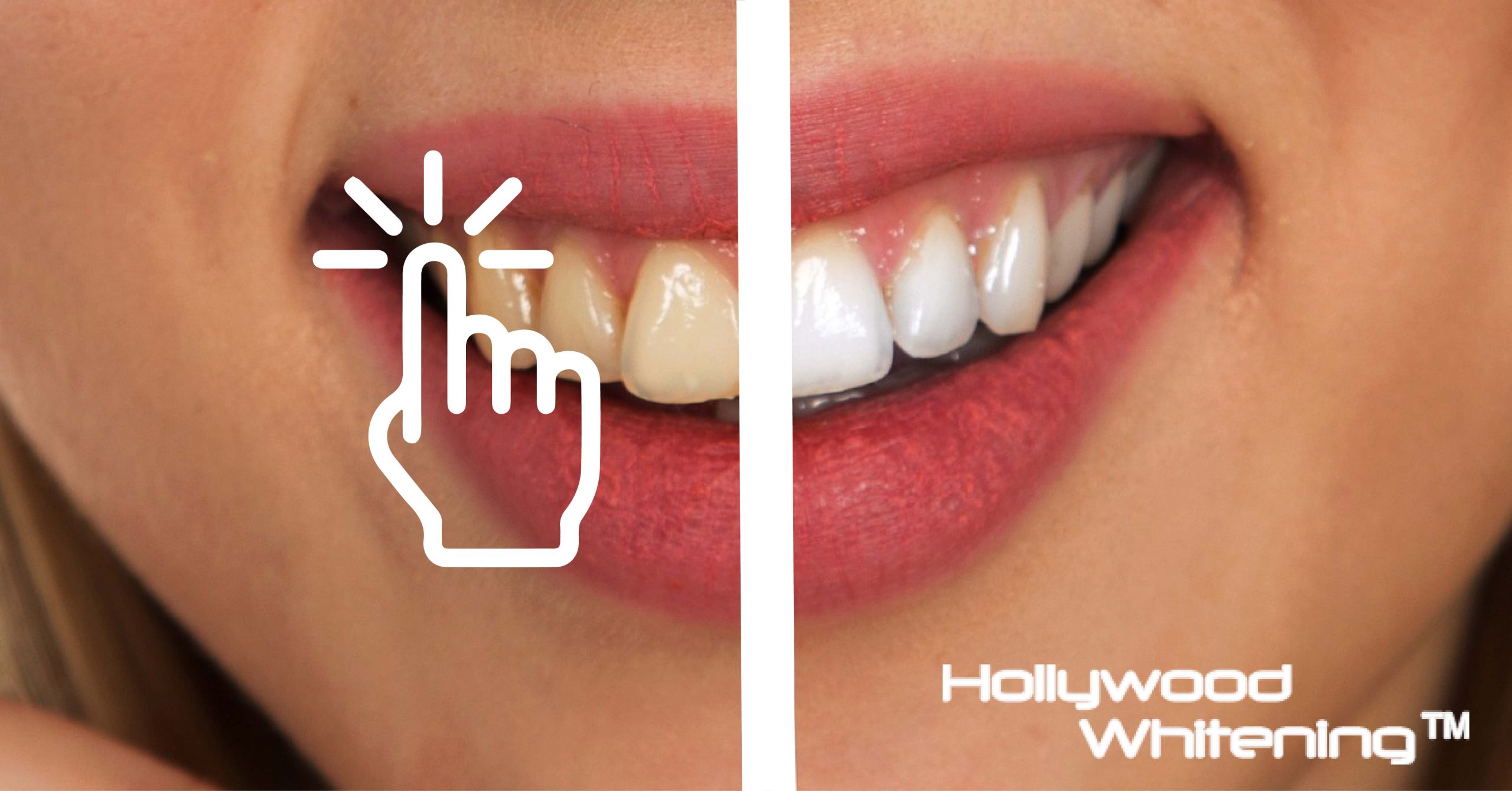 How Can You Whiten Your Teeth?